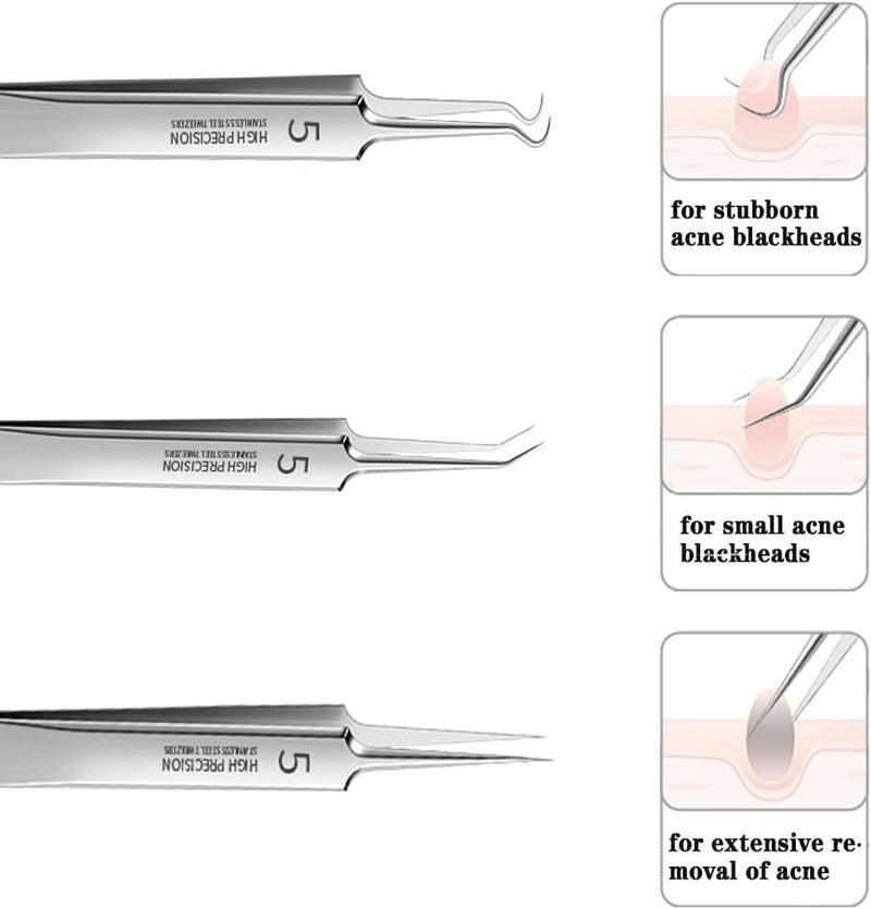 BLAAROOM Professional Facial Blackhead Remover Tweezers,3Pcs Precision Pimple Popper Tool Kit for Whitehead Ance Blemishs Comedones Stainless Steel Makeup Tool - Glossy - Image 3